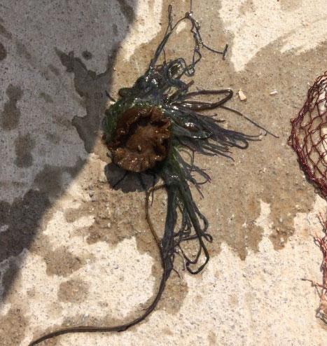 Çanakkalede denize giren 12 yaşındaki kız hayatının şokunu yaşadı