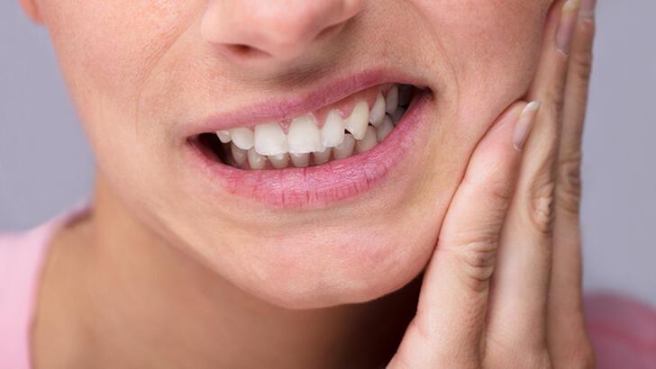 Diş İltihabına Ne İyi Gelir, Nasıl Geçer? Diş İltihabını Geçirecek Ve
