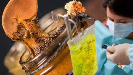Kanser tedavisinde arı ürünleri ne işe yarar: Propolis ile zeytinyağına dikkat!