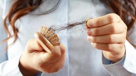 Saç dökülmesini durdurmak için en sık kullanılan yöntemler