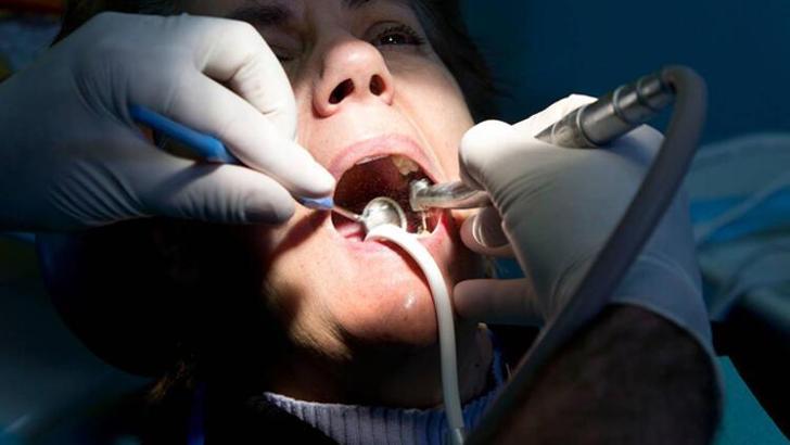 Diş hastaneleri açıldı mı? Dişçiler ne zaman açılacak?