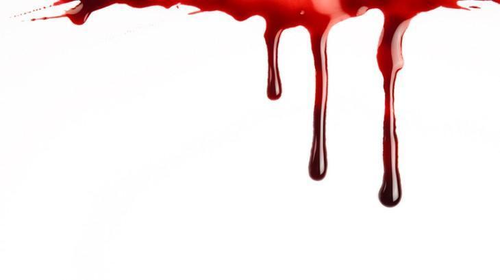 Rüyada Kan Görmek Nedir? Rüyada Kan Kusmak/Tükürmek, Kan Aldırıp Başka Birine Kan Vermek, Vücuttan Kan Aktığını Görmek Anlamı