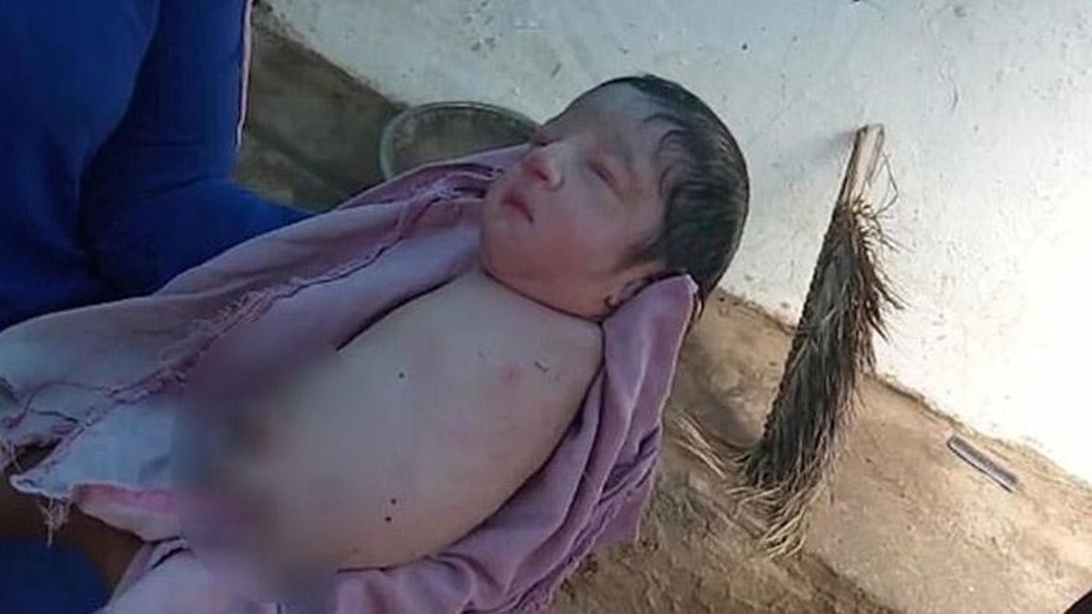 Hindistan'da bebek kolları ve bacakları olmadan doğdu - Güncel ...