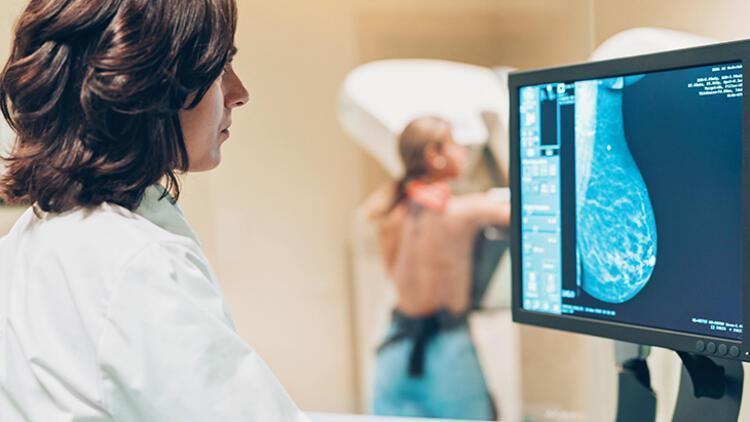 Why women over 75 may not need a mammogram