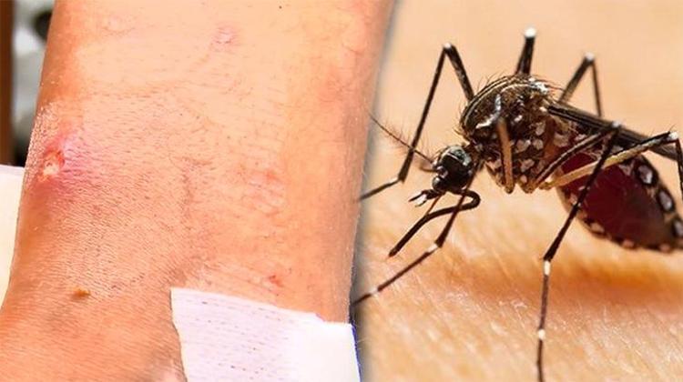 son dakika uzmanlar uyardi asya kaplan sivrisinegi guncel haberler milliyet