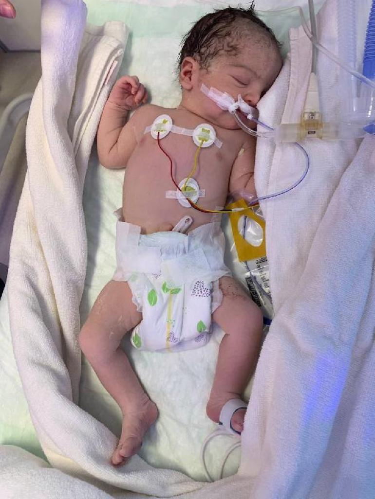 haberler Organları göğüs kafesinde doğan Lena bebeğe hayat veren dokunuş