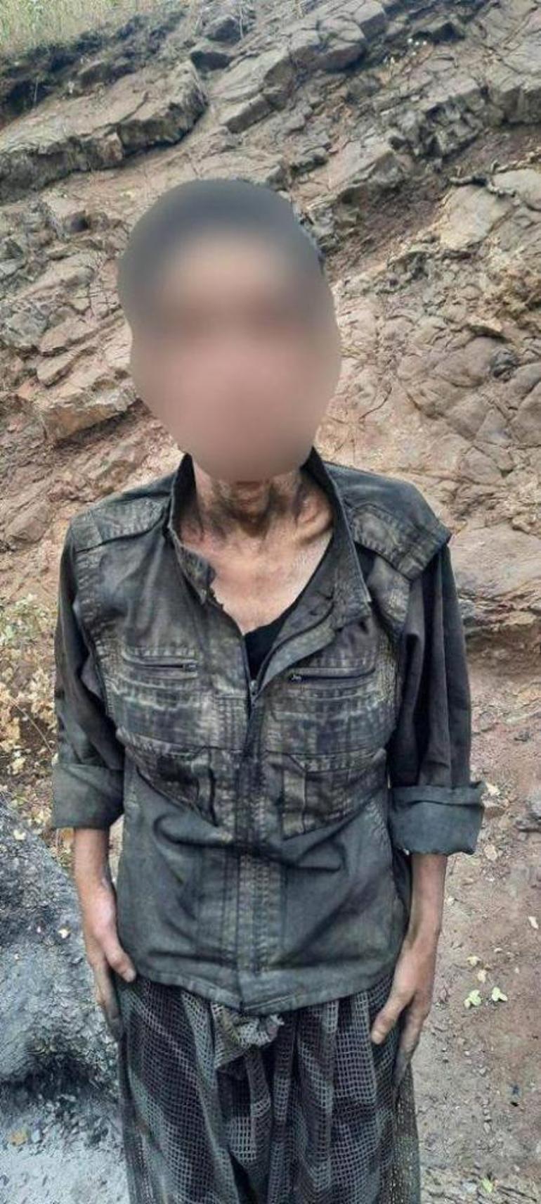 Teslim olan PKKlı teröristlerin görüntüsü ortaya çıktı  Açlıktan bağırsakları delindi
