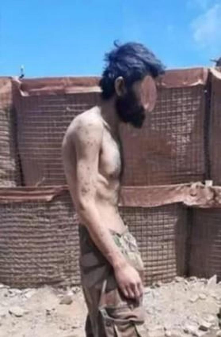 Teslim olan PKKlı teröristlerin görüntüsü ortaya çıktı  Açlıktan bağırsakları delindi